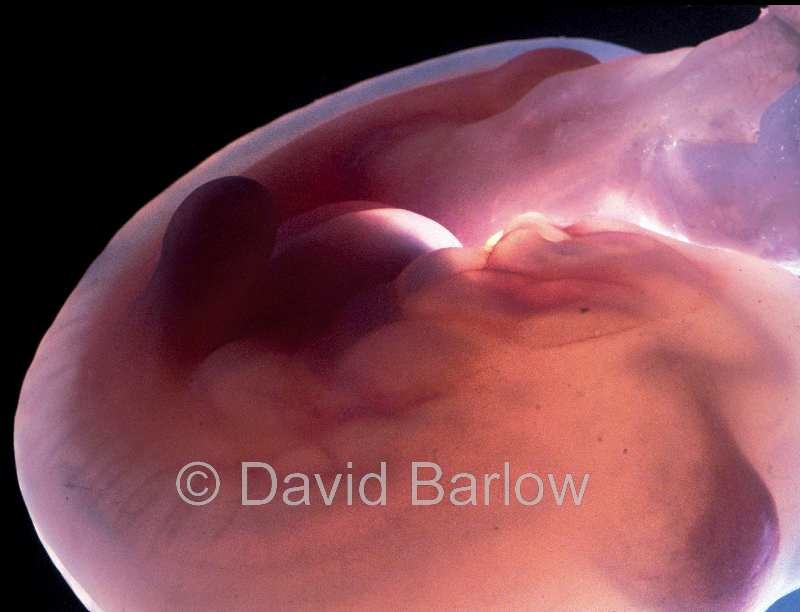 Head 4-6 week embryo