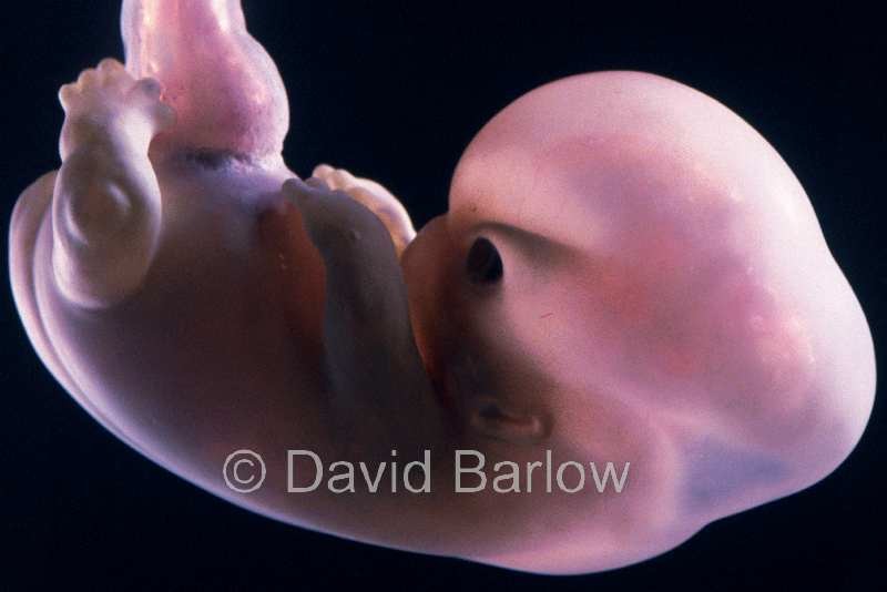 8 week human embryo