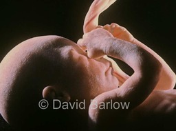 24 week human foetus graze highlights